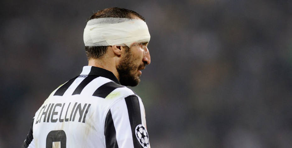 Giorgio Chiellini no podrá jugar la final por una lesión en el sóleo. Reuters.