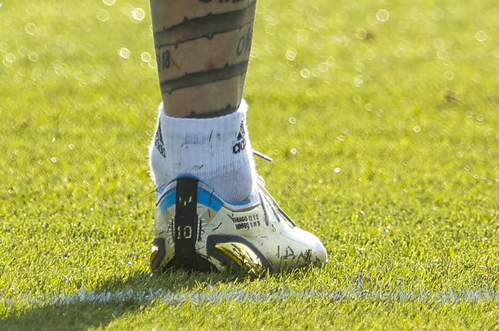 Imagen del tobillo de Leo Messi