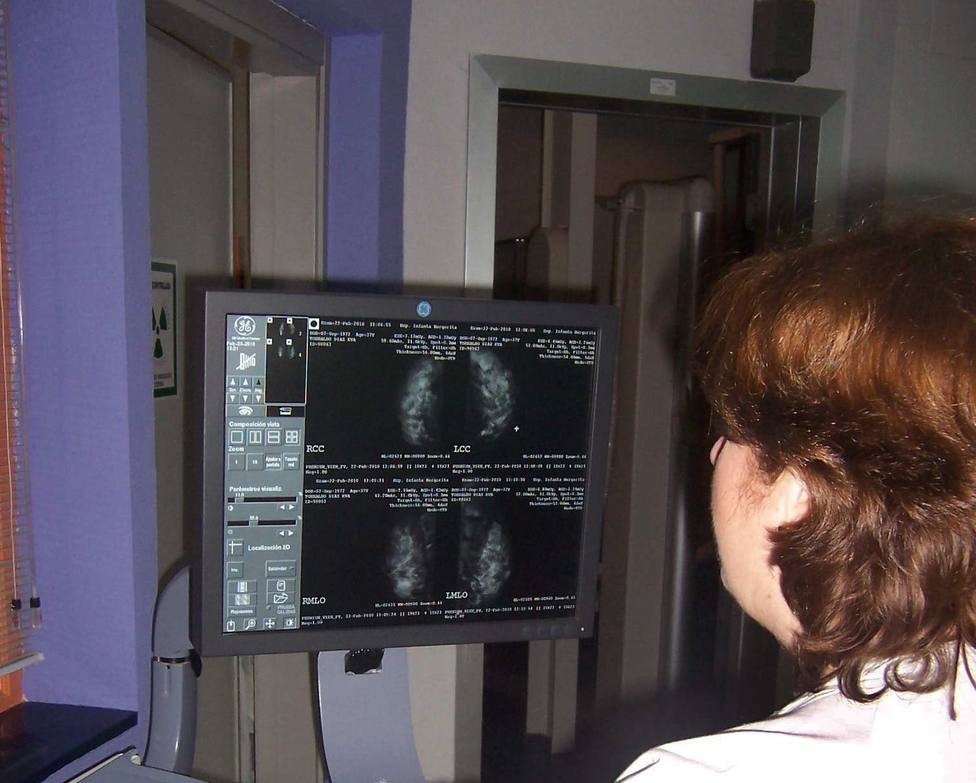 Programa de deteccion de cancer de mama
