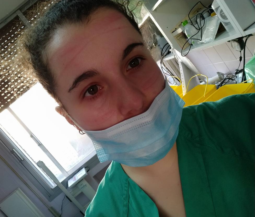 Noelia, enfermera del Clínico con las marcas en la cara a consecuencia del uso del EPI