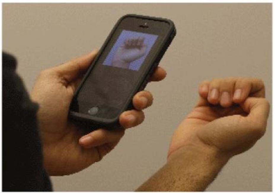 Investigadores desarrollan una aplicación móvil que puede detectar la anemia con una foto de las uñas