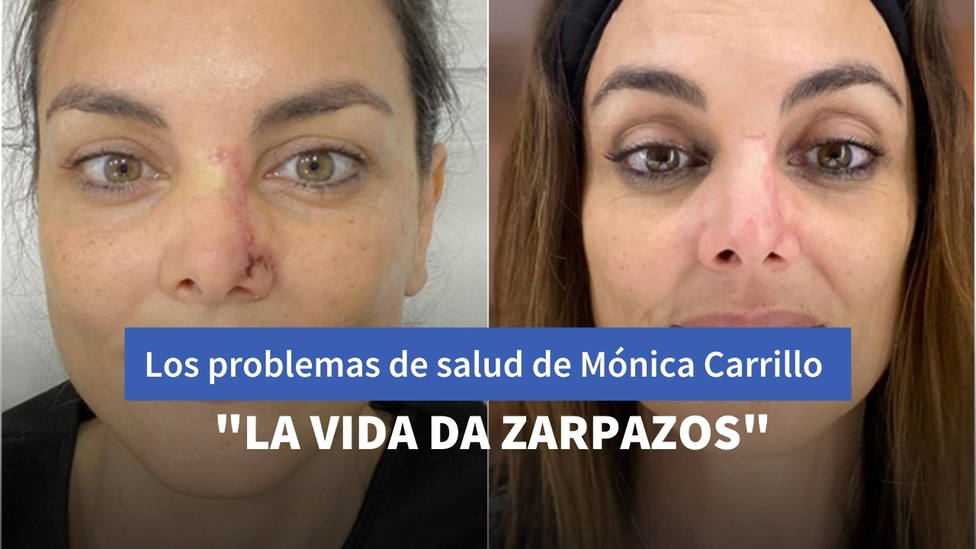 Mónica Carrillo confiesa los graves problemas de salud que ha sufrido en secreto: “La vida da zarpazos”