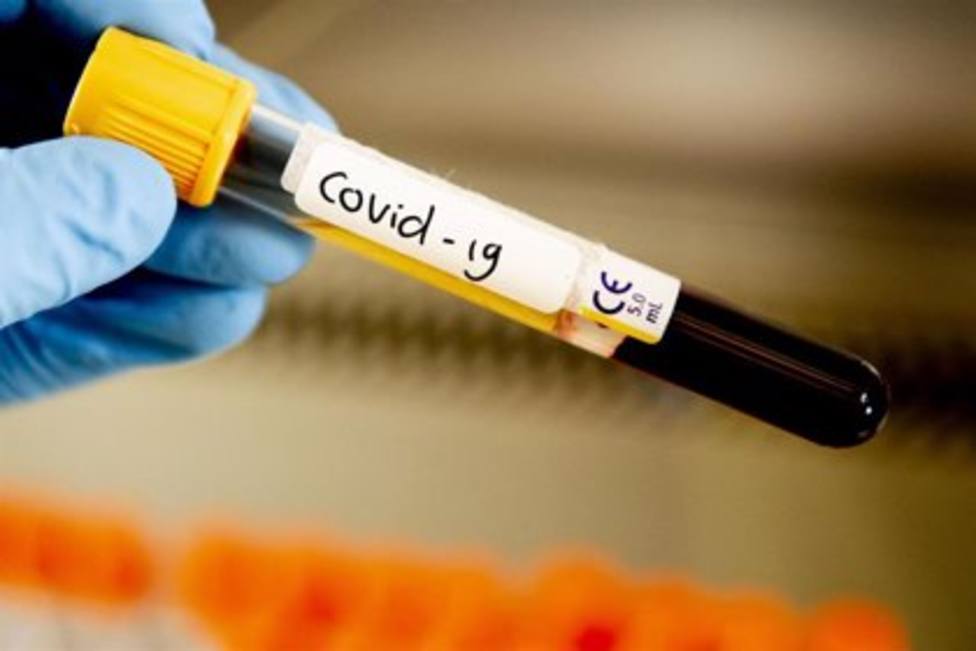 Coronavirus. COVID. Muestra de sangre